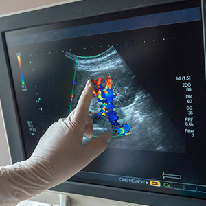 endoscopy ultrasound