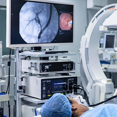 endoscopic retrograde cholangiopancreatography