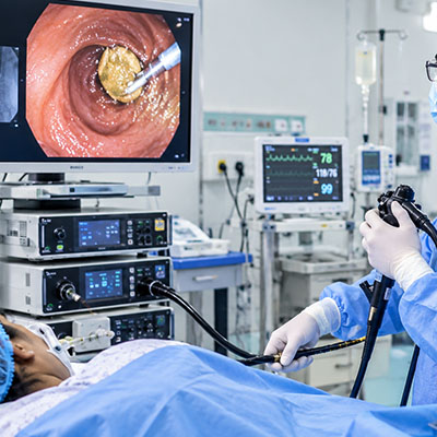 therapeutic endoscopy